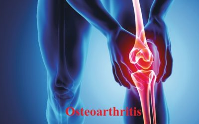 Stem cell therapy in Knee Osteoarthritis is promising